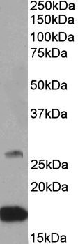 TGM7 Antibody