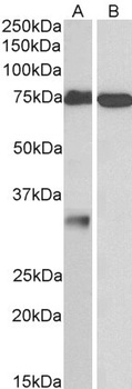 TGM7 Antibody