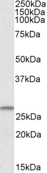 NLRP3 Antibody