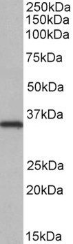 PCSK9 Antibody