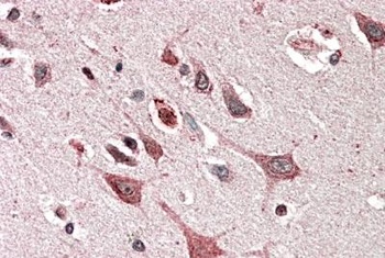 Lgals1 Antibody