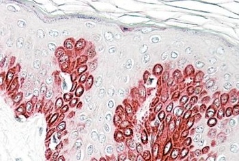 PPPDE1 Antibody