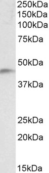 UBE2F Antibody