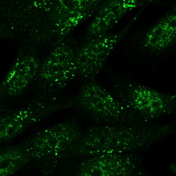 SLC4A11 Antibody