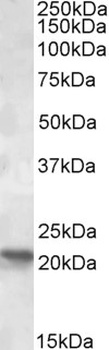 SKA3 Antibody