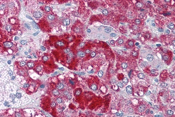 CSX1 Antibody