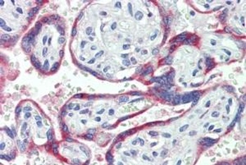 DRAK2 Antibody