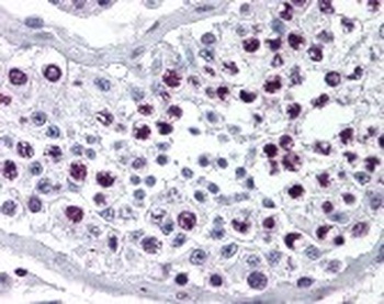 Cyclin A1 Antibody