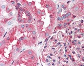 HSP90B2P Antibody