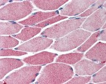 BACH1 Antibody
