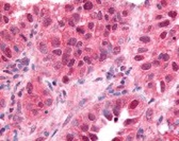 Early Growth Response 1 Antibody