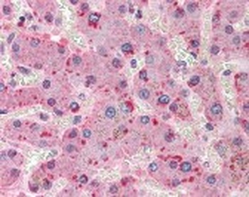 ORM1 Antibody