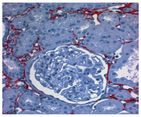 Type I Collagen Antibody