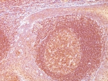 Bcl10 Antibody [SPM520]