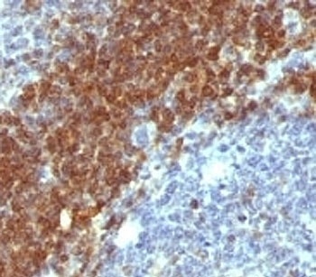 Bcl-2 Antibody [SPM530]
