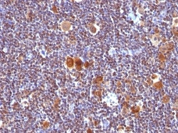 Bax Antibody [SPM336]