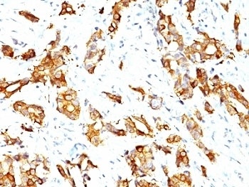 HSP27 Antibody [SPM252]