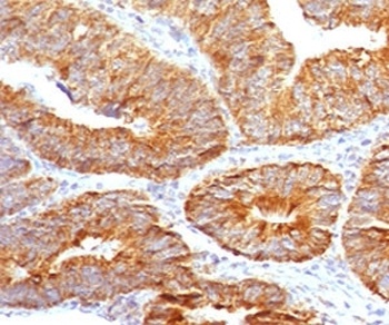 TL1A Antibody [TLRM1-1]