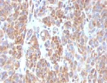 Bcl2 Antibody [ARBC2-1]