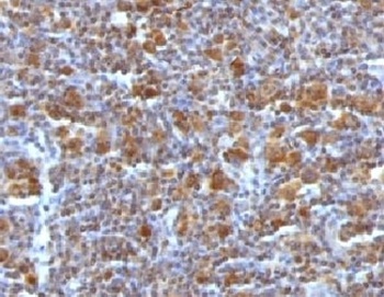 Bax Antibody [ARBX-1]