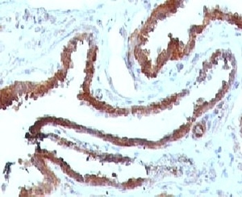 HSP27 Antibody [SRPR27]