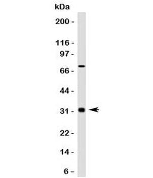 Bcl10 Antibody [MUBC10]