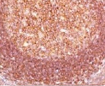 Bcl10 Antibody [MUBC10]