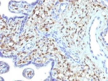 S100A4 Antibody [S100A4/1481]