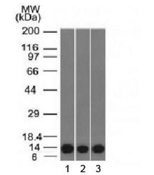 S100A4 Antibody [S100A4/1481]