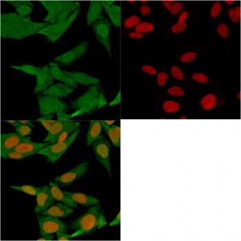 S100A4 Antibody [S100A4/1481]