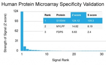 S100A4 Antibody [S100A4/1481]