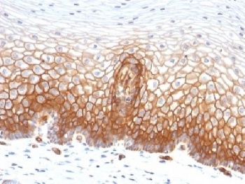 Thrombomodulin Antibody [THBD/1591]