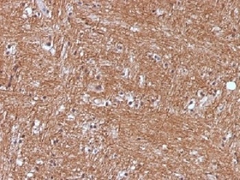 Neuron Specific Enolase Antibody [ENO2/1375]