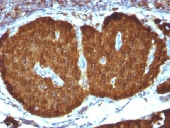 Neuron Specific Enolase Antibody [ENO2/1375]