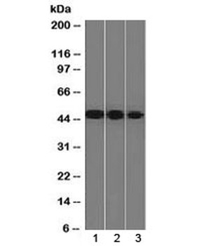 Neuron Specific Enolase Antibody [ENO2/1375]