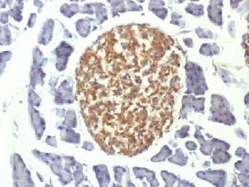 Neuron Specific Enolase Antibody [ENO2/1375]