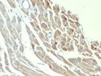 Neuron Specific Enolase Antibody [ENO2/1375]