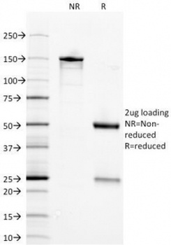 Neuron Specific Enolase Antibody [ENO2/1375]