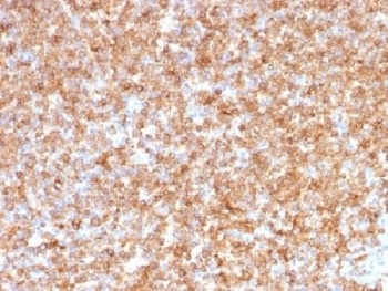 HLA-DP + HLA-DQ + HLA-DR Antibody [CR3/43]