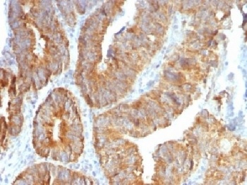 VEGI / TL1A Antibody [VEGI/1283]