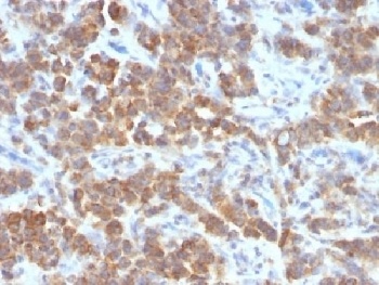 VEGI / TL1A Antibody [VEGI/1283]