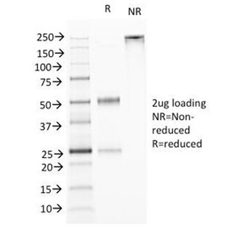 VEGI / TL1A Antibody [VEGI/1283]