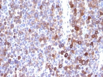 Moesin Antibody [MSN/491]
