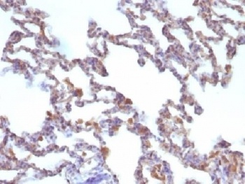 Moesin Antibody [MSN/491]