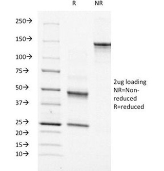Moesin Antibody [MSN/491]
