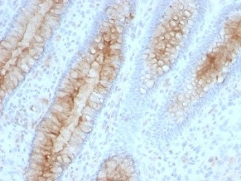 Beta-2 Microglobulin Antibody [B2M/961]