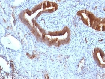 Beta-2 Microglobulin Antibody [B2M/961]