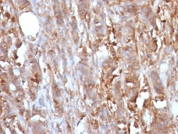 Beta-2 Microglobulin Antibody [B2M/961]