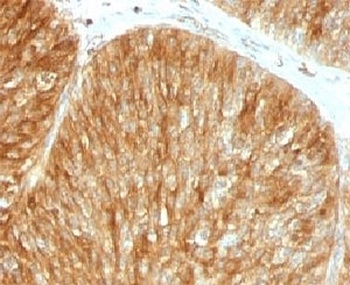 Beta-2 Microglobulin Antibody [B2M/961]