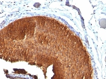 Cytokeratin 19 Antibody [KRT19/799]